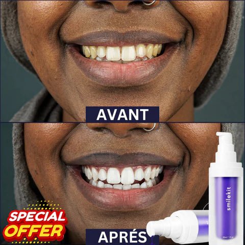 PATE DENTIFRICE POUR BLANCHIR LES DENTS EN 7 JOURS ! - ROI DU SHOPPING